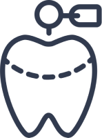 歯の治療イラスト